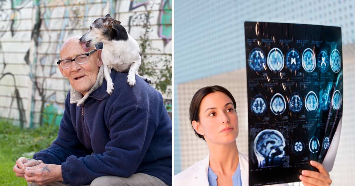 (L) Dog licking a man's head, (R) Doctor examining brain scan. (Representative Image Source: Getty Images | (L) janecampbell21, (R) Chis Ryan)