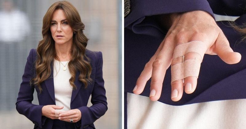 Kate Middleton Is Searched Before Touring a Prison Where She Sported a Visible 'Small Injury': Watch
