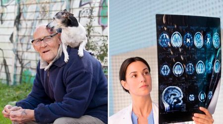 Family laughed off dogs’ odd habit of licking dad’s head — but doctors were alarmed by what they really sensed