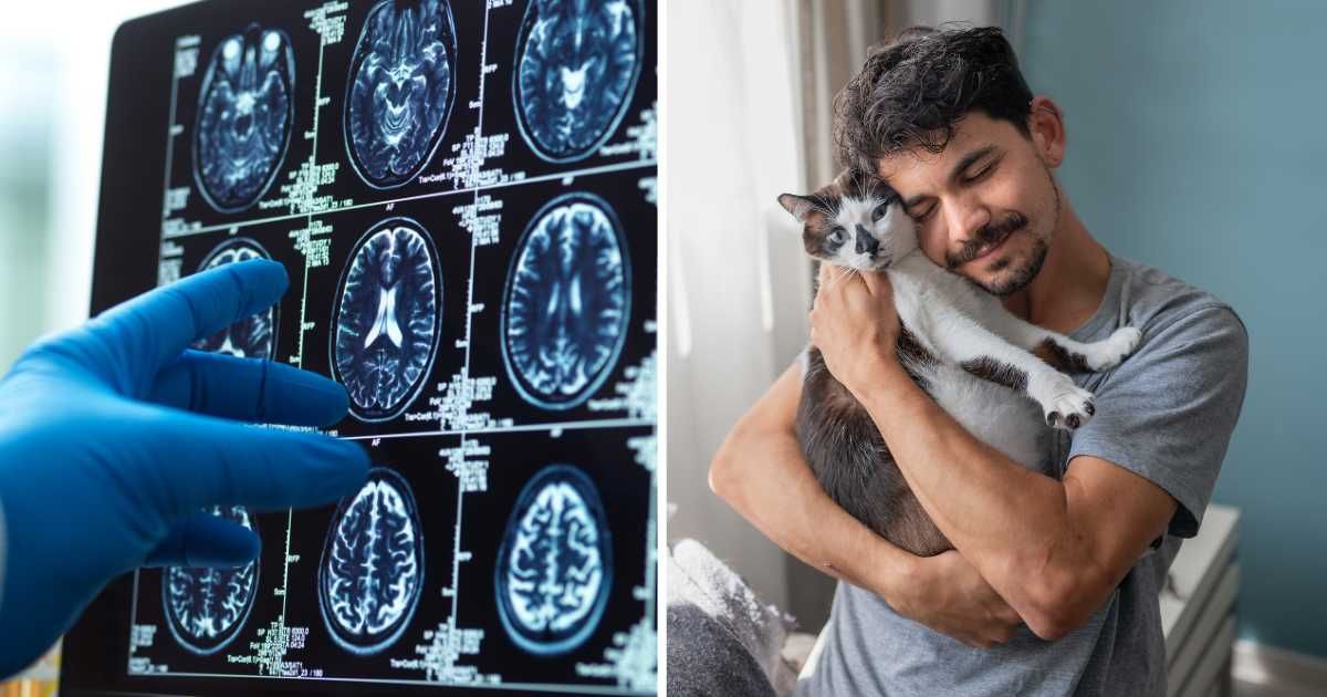 (L) A doctor checking a brain scan. (R) A man cuddles his cat. (Representative Cover Image Source: Getty Images | (L) Andrew Brookes, (R) Magui rfajardo)