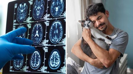 Photographer scans his brain to learn why cats are so irresistible — and discovers they’ve ‘hijacked’ our brains