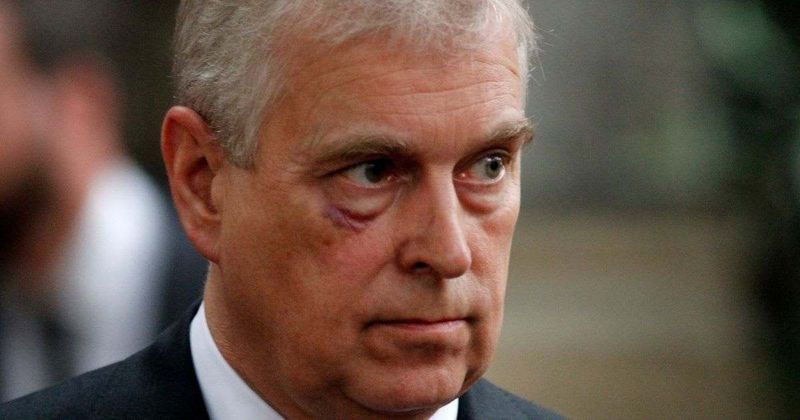 Andrew Spotted With Mysterious Bruise Just Days After Being Confronted by Balaclava-Wearing Man